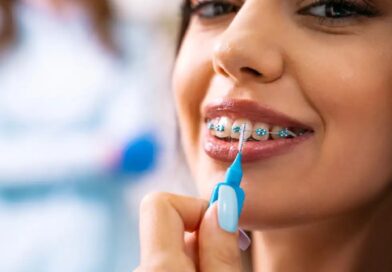 How To Maintain Oral Hygiene With Invisalign Braces